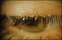 ������������ ����������� ����. ���������